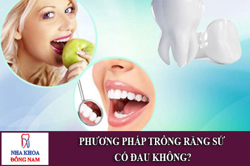 phương pháp trồng răng sứ có đau không