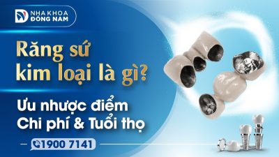 Răng sứ kim loại là gì