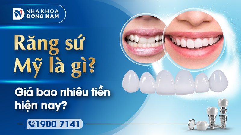 Răng sứ Mỹ là gì