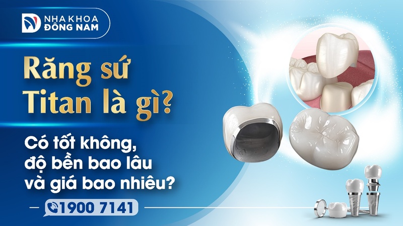 Răng sứ Titan là gì có tốt không