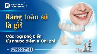 Răng toàn sứ là gì