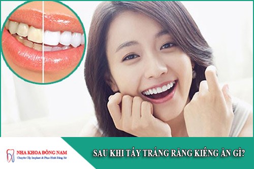sau khi tẩy trắng răng kiêng ăn gì