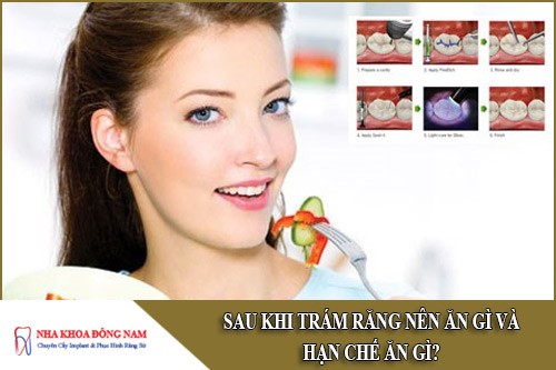 sau khi trám răng nên ăn gì và hạn chế ăn gì