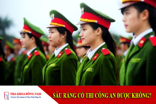 sâu răng có thi công an được không