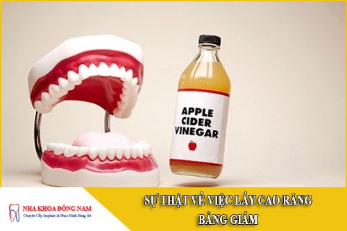sự thật về việc lấy cao răng bằng giấm