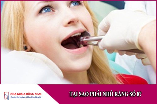 tại sao phải nhổ răng số 8
