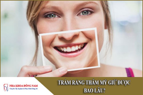 trám răng thẩm mỹ giữ được bao lâu