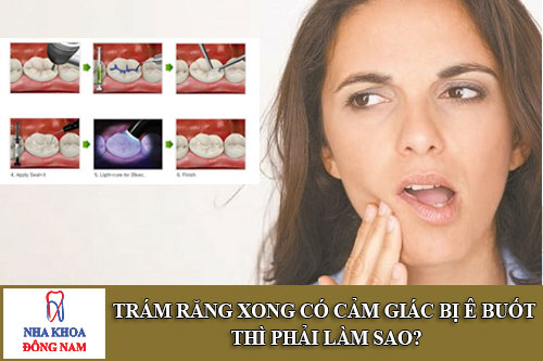 trám răng xong có cảm giác bị ê buốt thì phải làm sao
