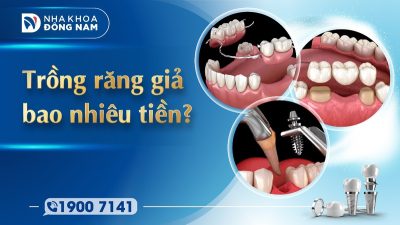 Trồng răng giả bao nhiêu tiền