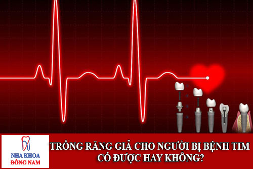 trồng răng giả cho người bị bệnh tim có được hay không