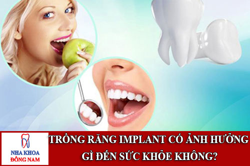 trồng răng implant có ảnh hưởng gì đến sức khỏe không?