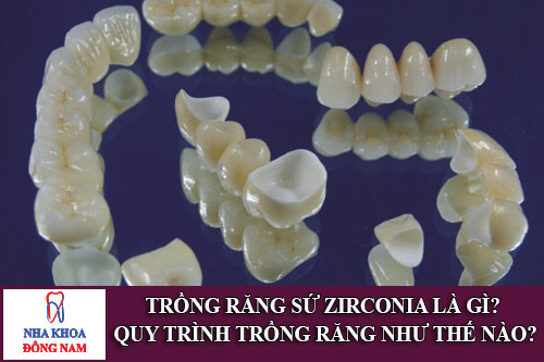 trồng răng sứ zirconia là gì? quy trình trồng răng như thế nào?