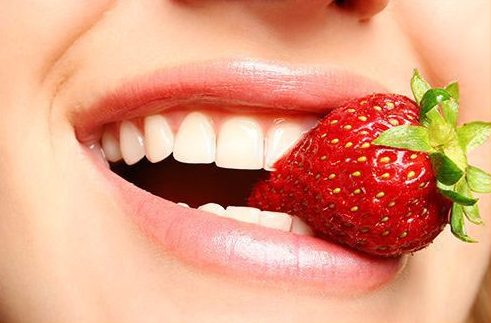 ưu nhược điểm của phương pháp dán răng sứ 5
