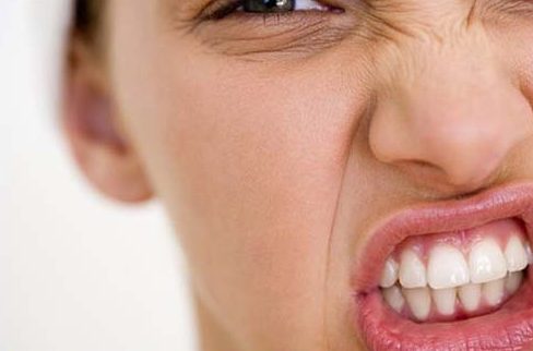 ưu nhược điểm của phương pháp dán răng sứ 8