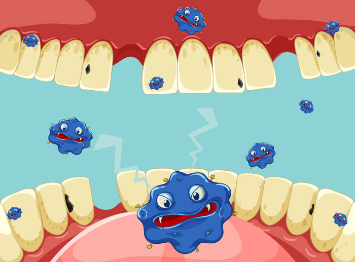 Vi khuẩn Streptococcus Mutans là nguyên nhân chính gây sâu răng