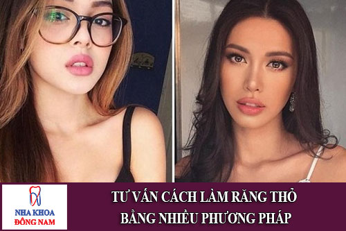 tư vấn cách làm răng thỏ bằng nhiều phương pháp