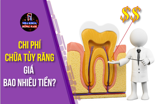 Giải Đáp: Chi phí CHỮA TỦY RĂNG giá bao nhiêu tiền?