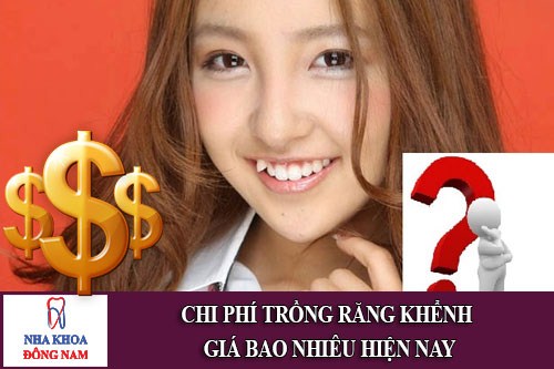 Chi phí trồng răng khểnh hiện nay giá bao nhiêu