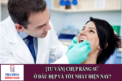 chụp răng sứ ở đâu đẹp và tốt nhất hiện nay