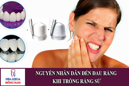 nguyên nhân dẫn đến đau răng khi trồng răng sứ