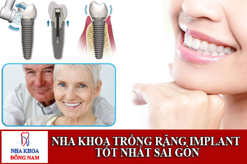 nha khoa trồng răng implant tốt nhất sài gòn