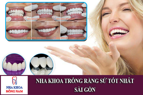 nha khoa trồng răng sứ tốt nhất sài gòn