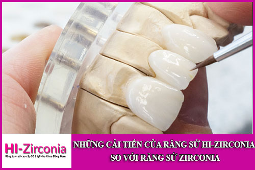 những cải tiến của răng sứ hi-zirconia so với răng sứ zirconia
