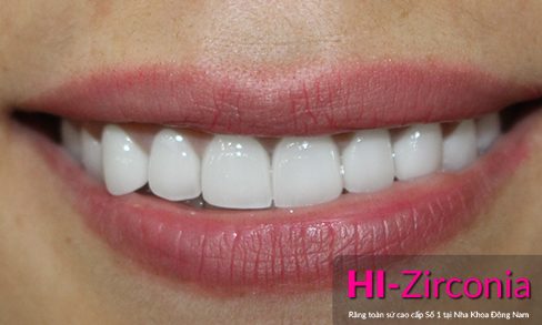 những ưu điểm vượt bật của răng sứ hi-zirconia 4