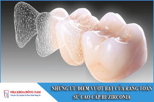 những ưu điểm vượt bật của răng sứ hi-zirconia