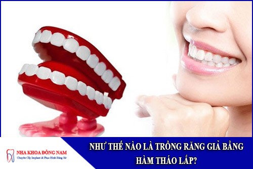như thế nào là trồng răng giả bằng hàm tháo lắp