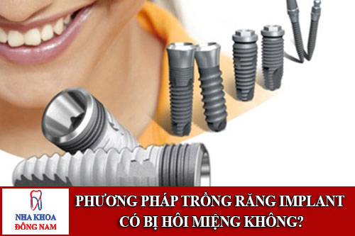 phương pháp trồng răng implant có bị hôi miệng không