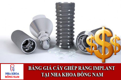 bảng giá cấy ghép răng implant tại nha khoa đông nam