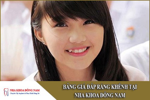 bảng giá đắp răng khểnh tại nha khoa đông nam