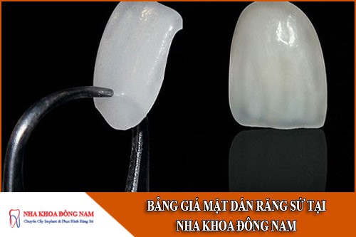 bảng giá mặt dán răng sứ tại nha khoa đông nam