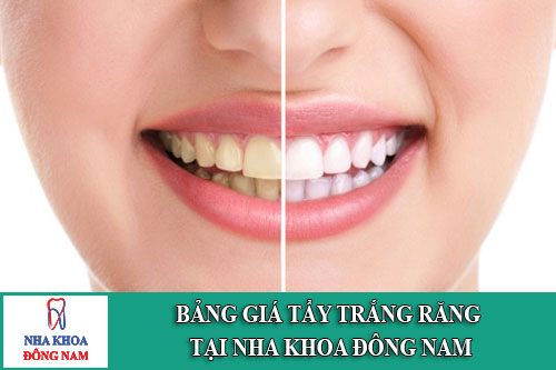 bảng giá tẩy trắng răng tại nha khoa đông nam