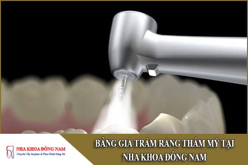 bảng giá trám răng thẩm mỹ tại nha khoa đông nam