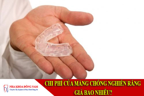 Chi phí của máng chống nghiến răng giá bao nhiêu