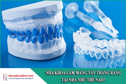 nha khoa làm máng tẩy trắng tăng tại nhà như thế nào