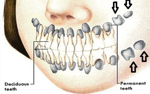 răng hàm có thay không 3