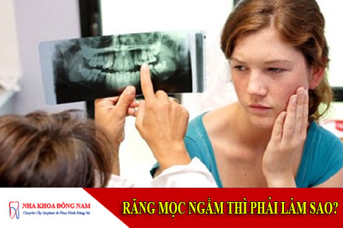 răng mọc ngầm thì phải làm sao