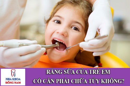 răng sữa của trẻ em có cần phải chữa tủy không