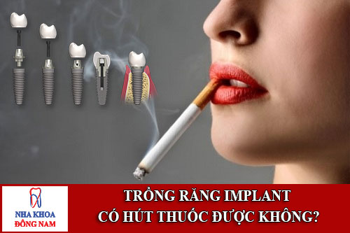 trồng răng implant có hút thuốc được không
