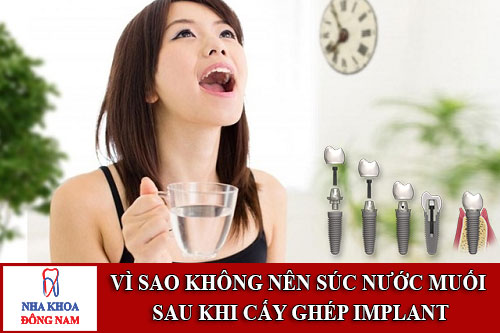 vì sao không nên súc nước muối sau khi cấy ghép implant