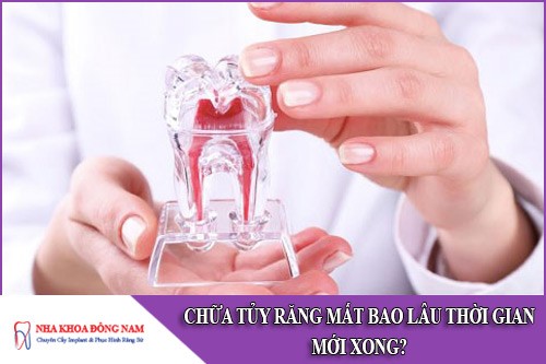 chữa tủy răng mất bao lâu thời gian mới xong