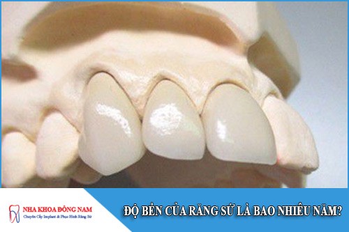 độ bền của răng sứ là bao nhiêu năm