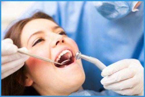 những điều cần biết trước khi bọc răng sứ