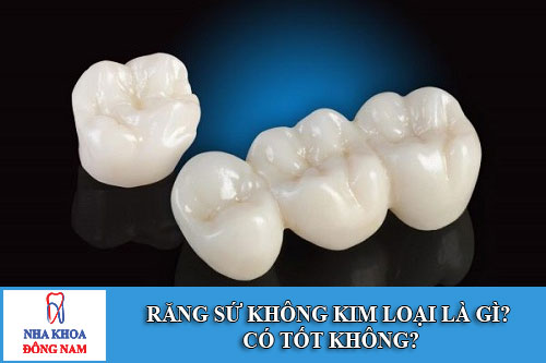 rang su khong kim loai la gi? co tot khong