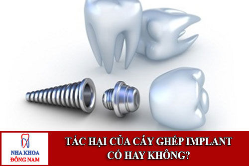 tác hại của cấy ghép implant, có hay không