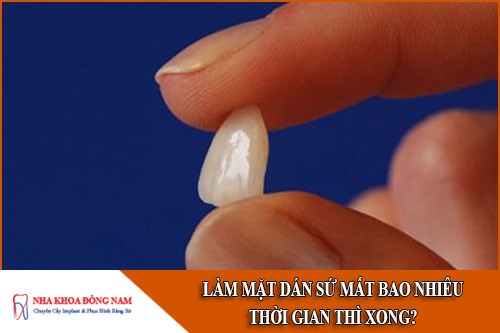 làm mặt dán sứ mất bao nhiêu thời gian thì xong