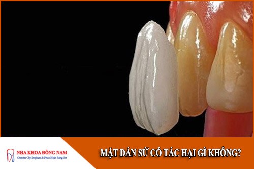 mặt dán sứ có tác hại gì không